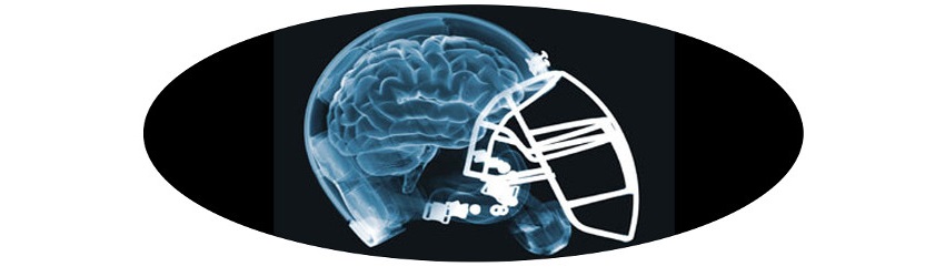 NFLConcussion.jpg